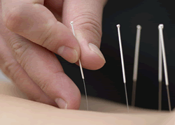 1 Day Beijing Traditional Chinese Medicine Study Tour